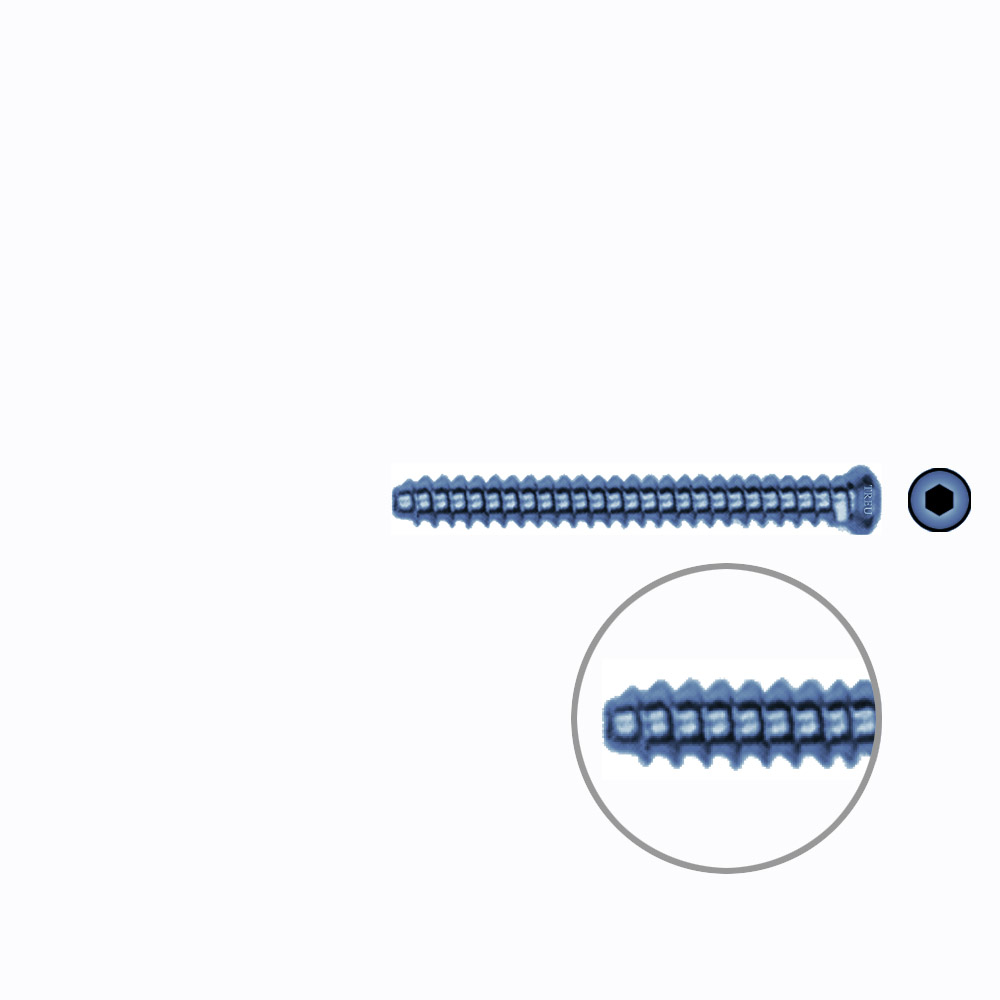 Hollow Screw 3,5 x 34mm full thread SELF TAPPING TITANIUM 