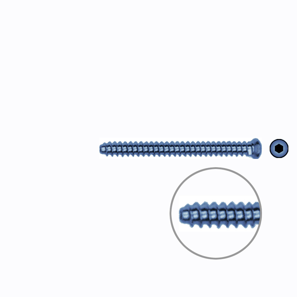 Hollow Screw 3,5 x 38mm full thread SELF TAPPING TITANIUM 