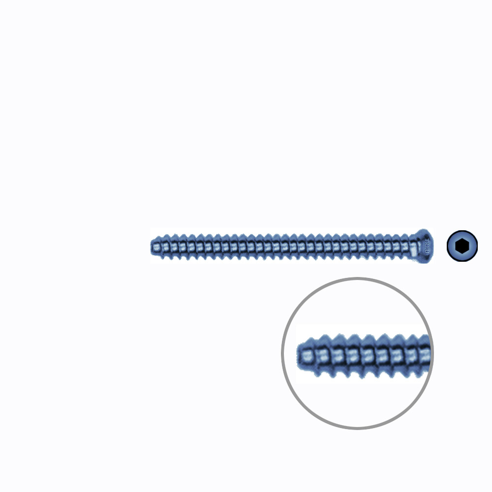 Hollow Screw 3,5 x 40mm full thread SELF TAPPING TITANIUM 