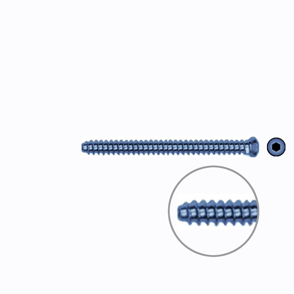 Hollow Screw 3,5 x 42mm full thread SELF TAPPING TITANIUM 