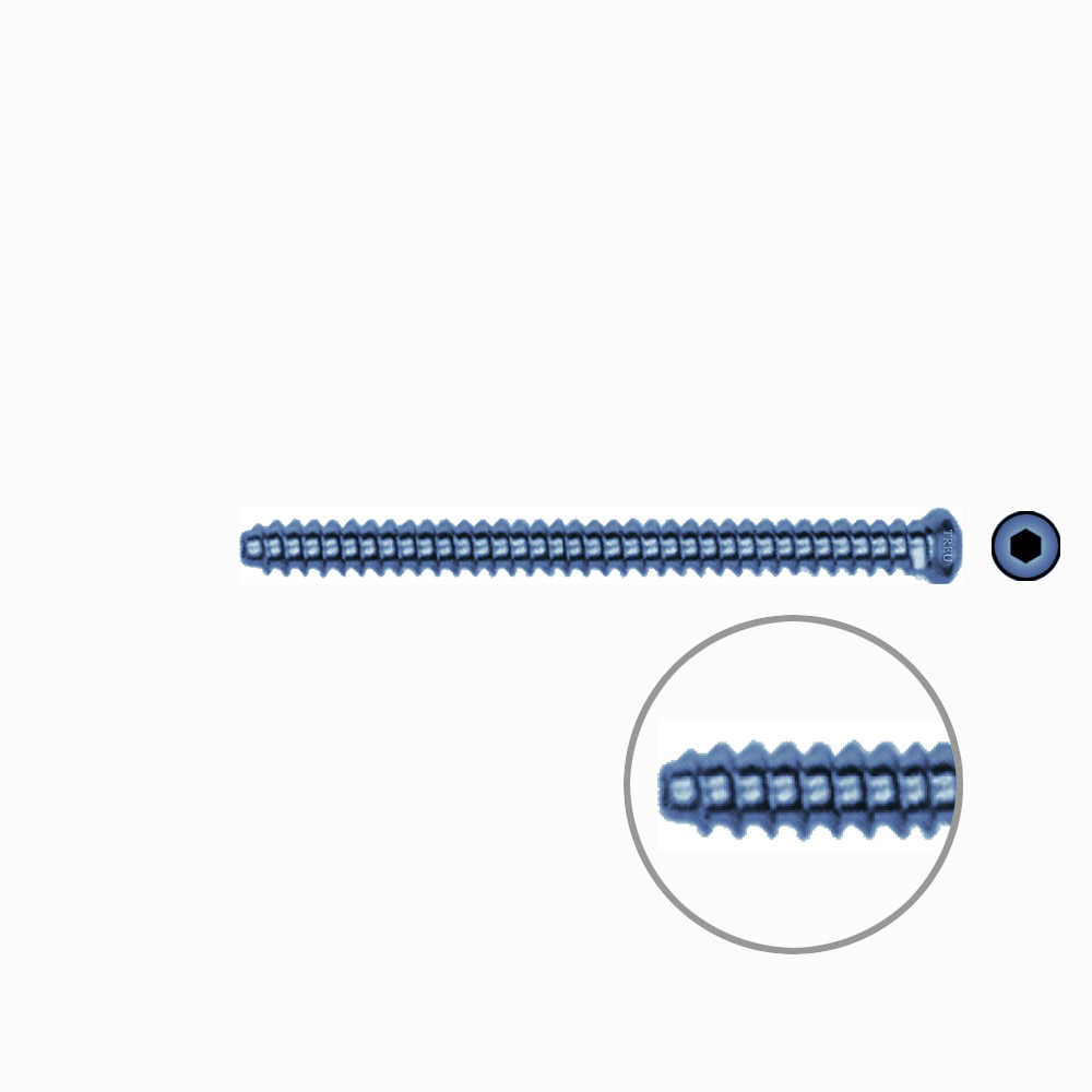 Hollow Screw 3,5 x 46mm full thread SELF TAPPING TITANIUM 