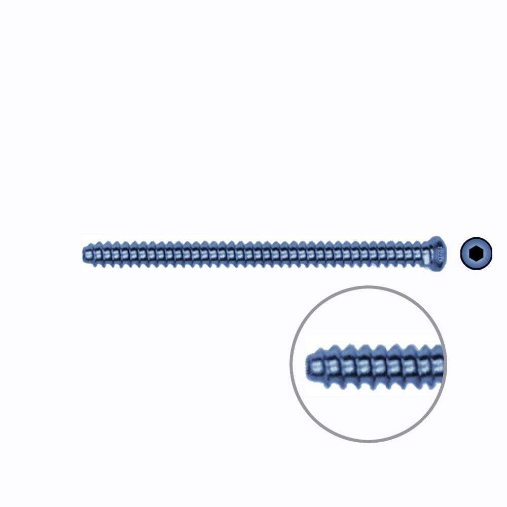 Hollow Screw 3,5 x 50mm full thread SELF TAPPING TITANIUM 