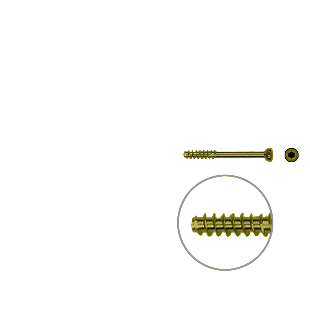 Hollow screw 4,0x30 mm self cutting Titan 