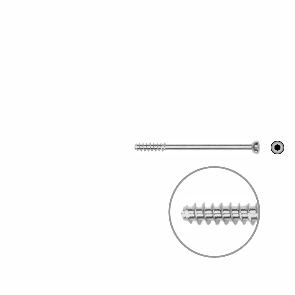 Hollow Screw 4,0 x 44mm HG Selfcutting 