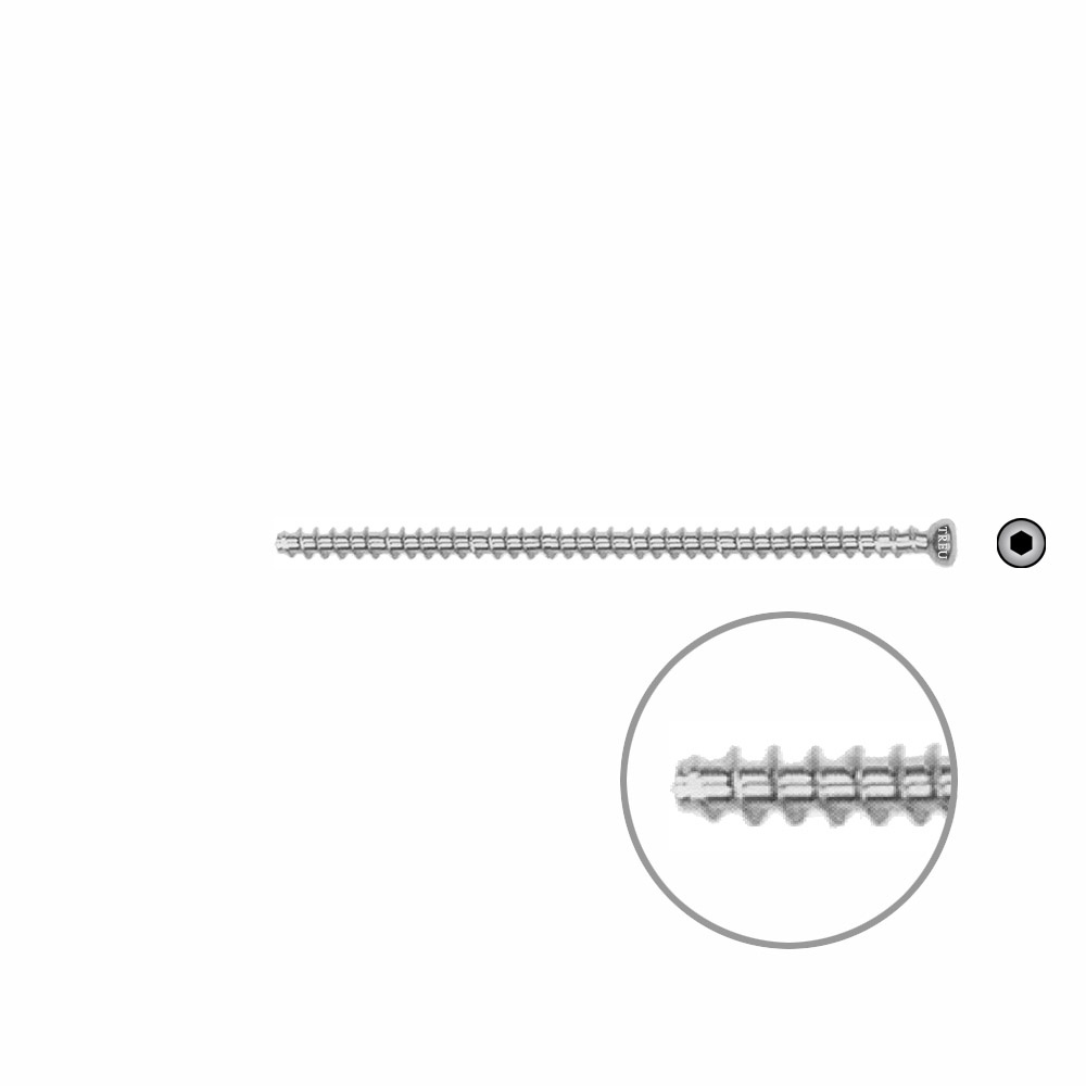 Hohlschraube 4,0 VG 65mm 