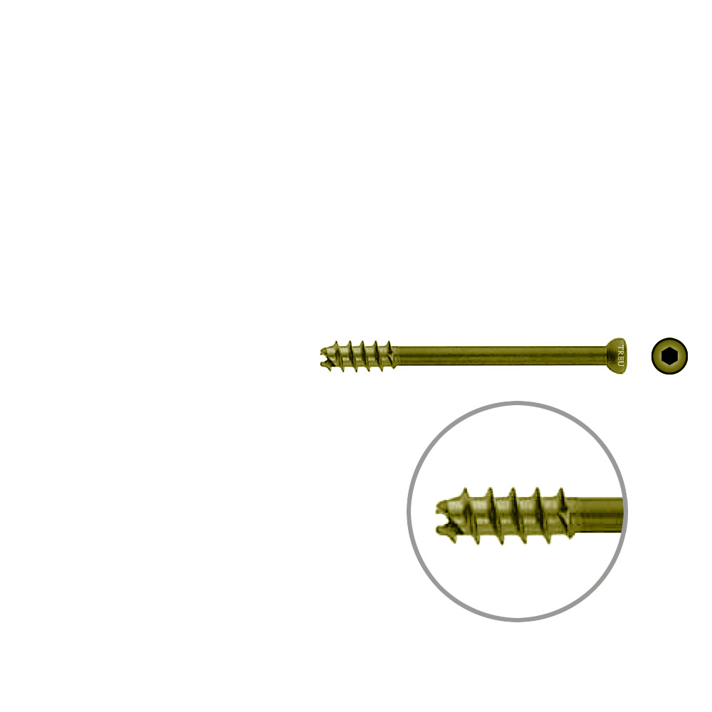 Hohlschraube 7mm Dia x 65mm 16 G selbstschneidend, TITAN 