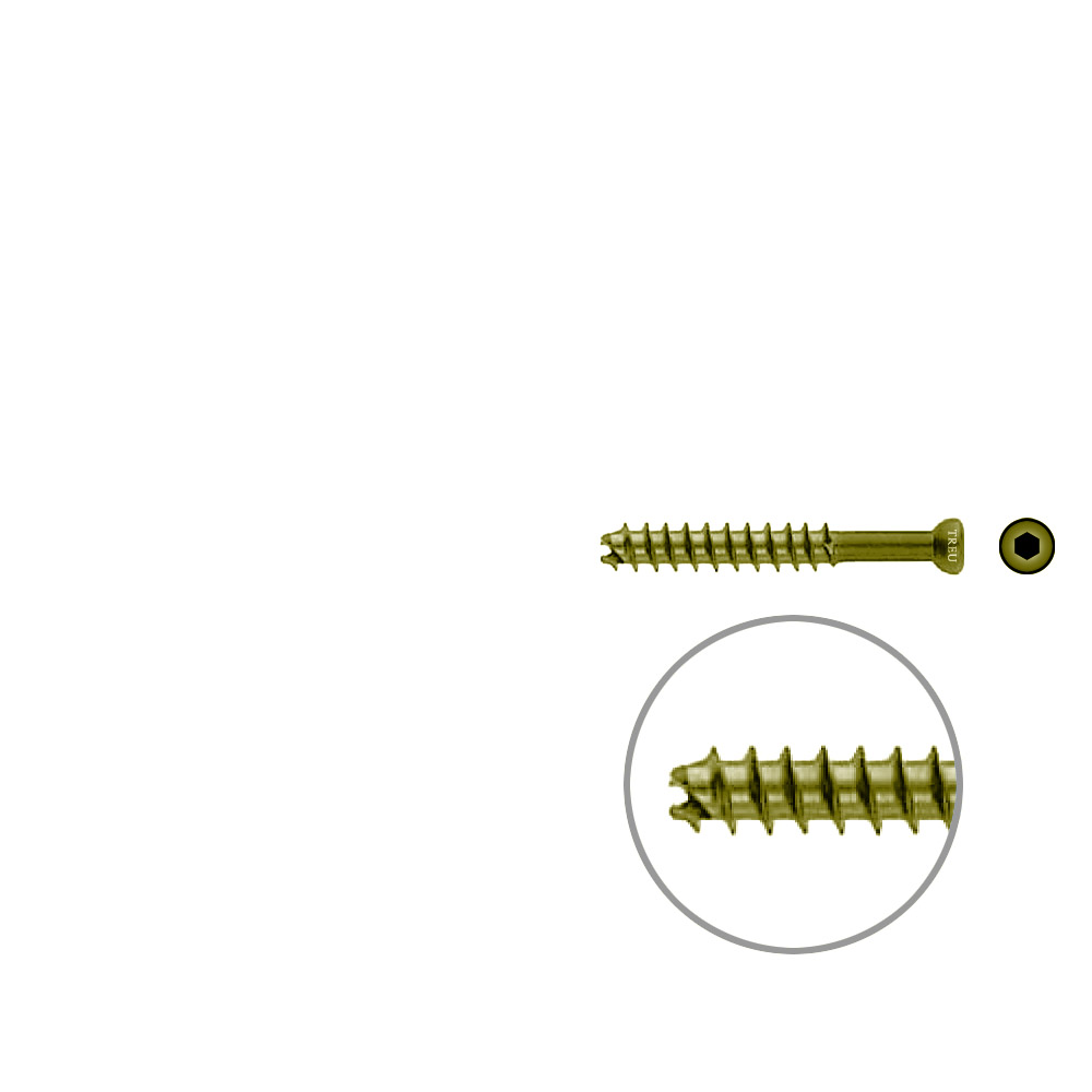 Hohlschraube 7mm Dia x 50mm 32 G selbstschneidend, TITAN 