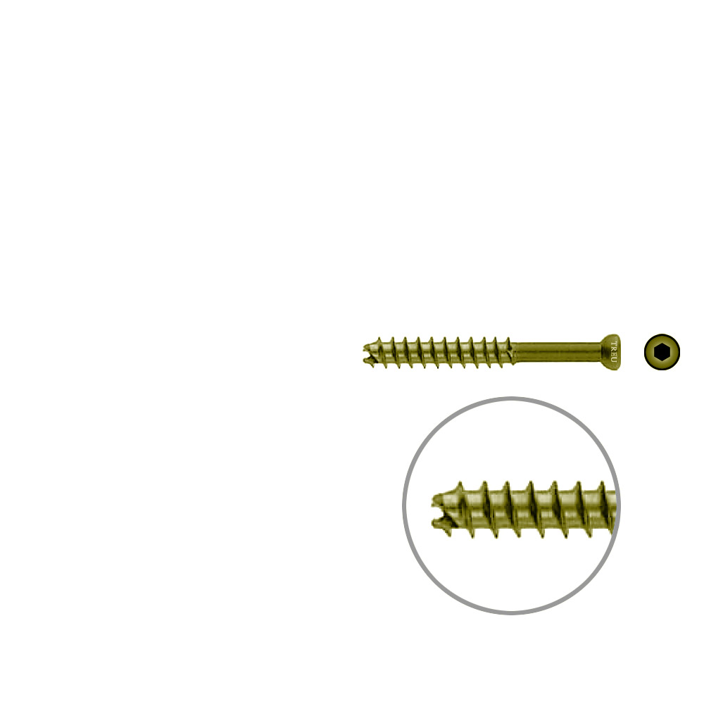 Hohlschraube 7mm Dia x 55mm 32 G selbstschneidend, TITAN 